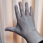 本日4月1日の手。げっそり痩せています（右手だけは）